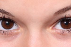 Will I Need to Wear Contacts After LASIK? featured image