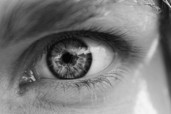 If I Have a Pre-Existing Eye Condition, Can I Get LASIK? featured image